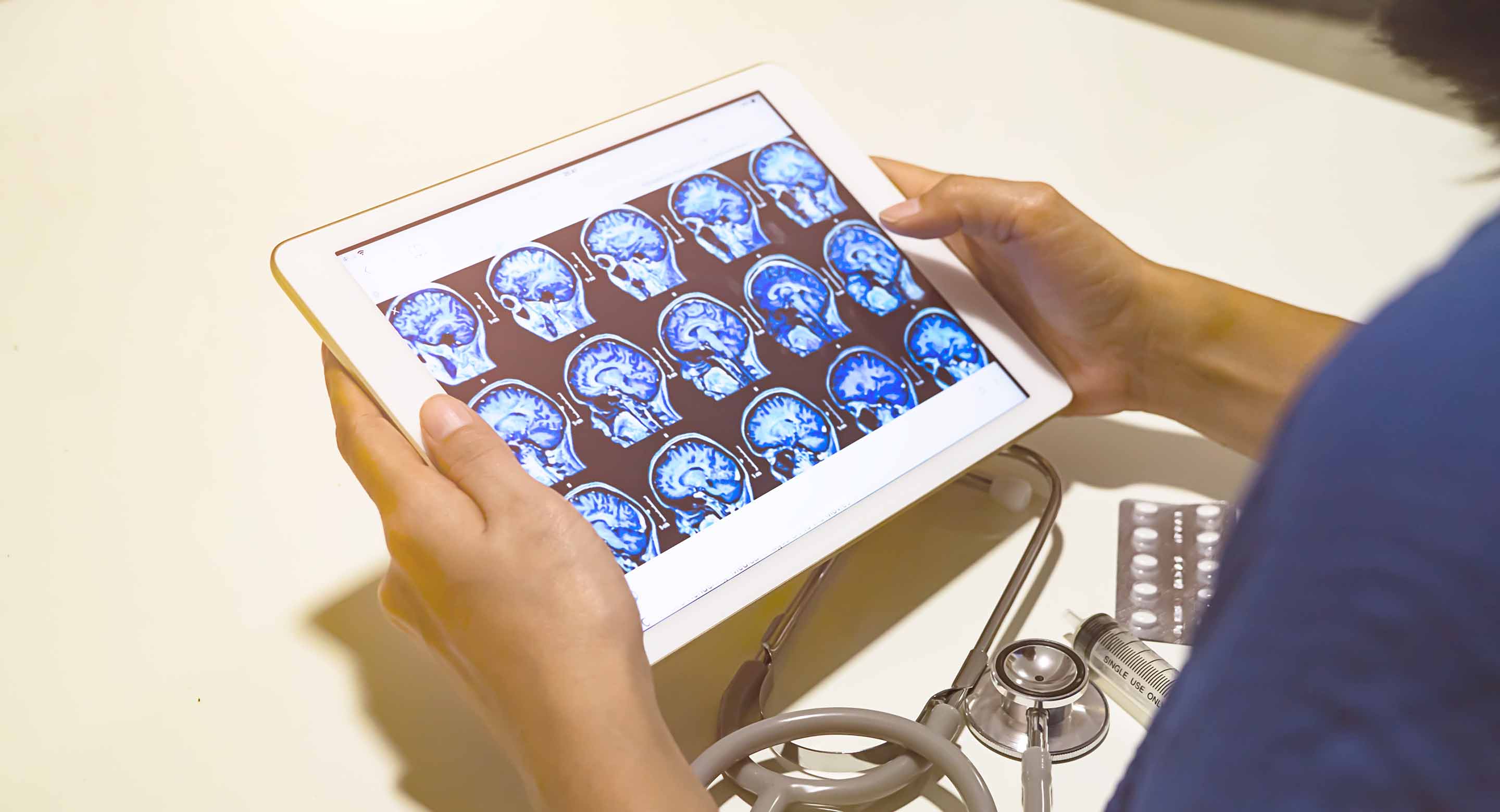 Clinician looking at a brain scan on a tablet
